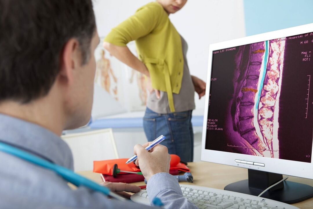Diagnóstico de osteocondosis lumbar